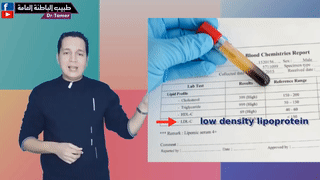 كيفية قراءة تحليل الكوليسترول