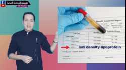 كيفية قراءة تحليل الكوليسترول