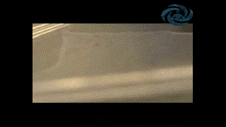 زراعة الأعضاء بالخلايا الجذعية