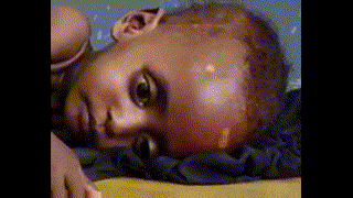 المجاعة في القرن الأفريقي